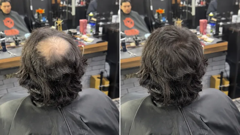 Before and after of a custom-made partial hairpiece for a localized hair loss area
